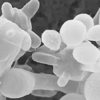 White fungus is more dangerous than black fungus
