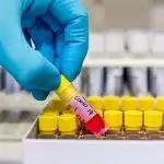 Corona infect number crosses 78 thousand in India, 2,547 people have died so far