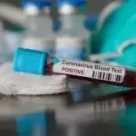 Corona confirmed in 10 people including BJP MLA’s father and Mother in Meerut