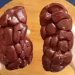 Top 4 Foods To Improve Kidney Health