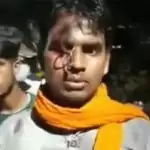 Uttarakhand: Policeman stabs key into man’s forehead for not wearing helmet