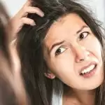 Two Ways to Get Rid of Dandruff in Winters