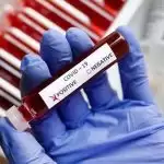 173 new corona infected confirmed in Meerut