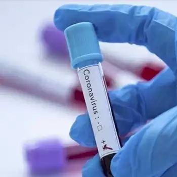 Covid-19 cases reduces in Meerut, 145 new patients confirmed