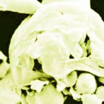 Madhya Pradesh: First case of creamy fungus found in Jabalpur