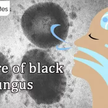 Beware of black fungus
