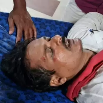 Bihar assembly uproar:  Many MLAs brutally beaten by police, hospitalized