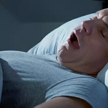 Snoring & Sleep Apnoea