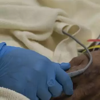 One in four patients admitted to hospital in critical condition will die: Study