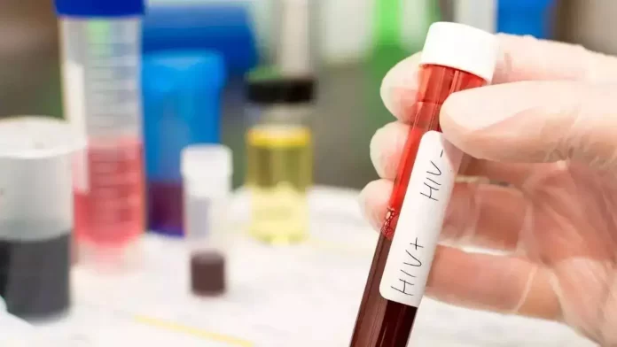 New-born baby of HIV-positive dies